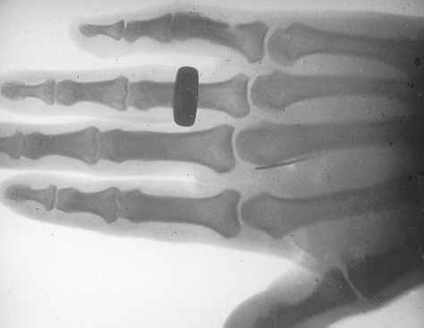 Xray_ndl.jpg (9212 bytes)